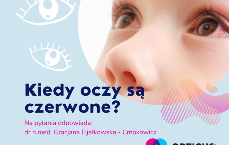 kiedy-oczy-są-czerwone