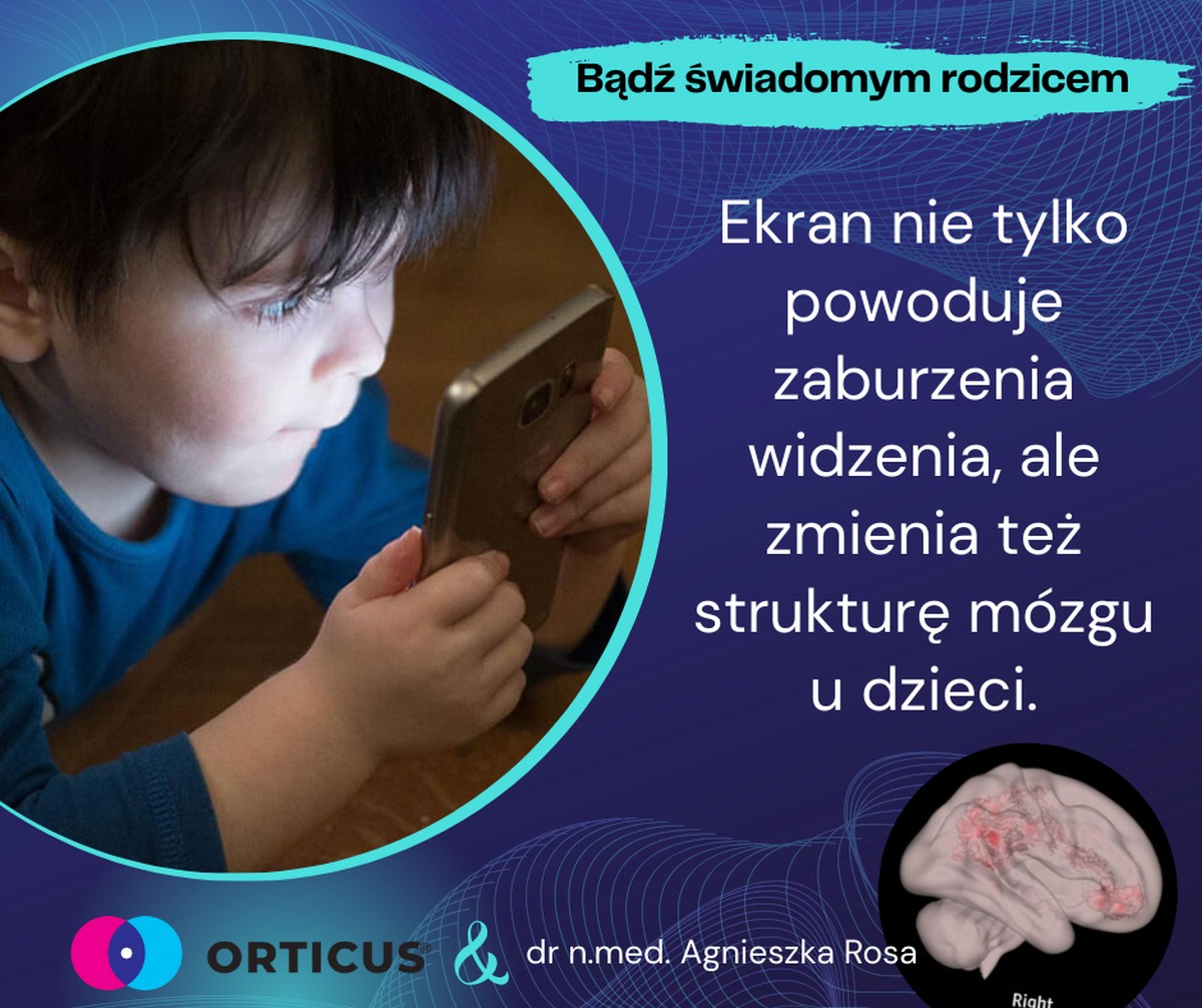 orticus-wplyw-ekranow-na-wzrok-dziecka